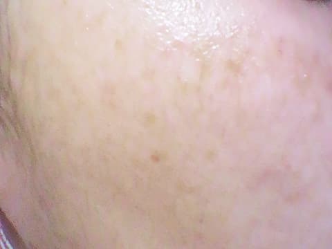 えみりっちさん使用後