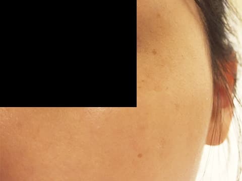 imi87さん使用前