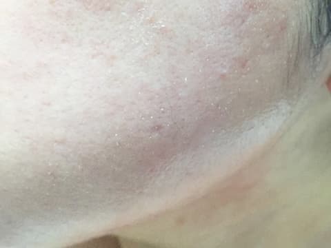 ひかりさん使用後