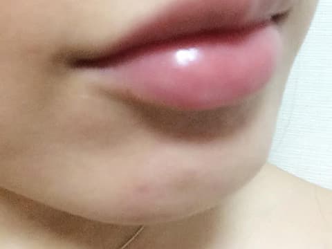 さくらさん使用後