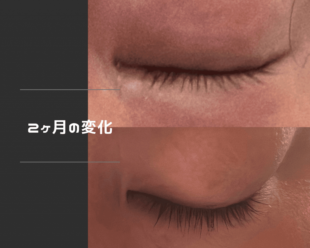 レビュー投稿画像