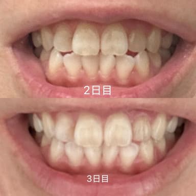 [Colgate]オプティックホワイト プラスシャイン 【1箱100g】 レビュー投稿画像 サムネイル