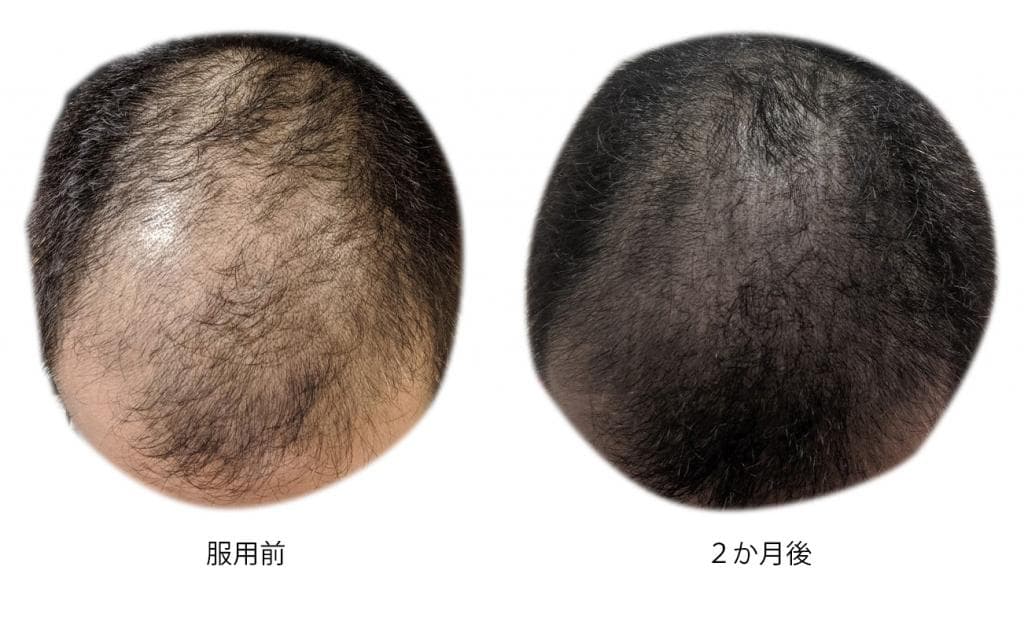 レビュー投稿画像