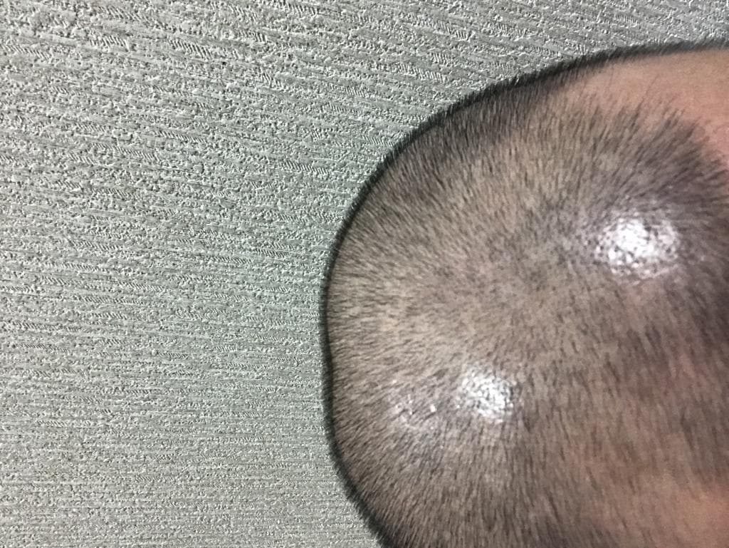 レビュー投稿画像