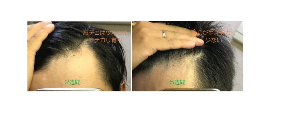 レビュー投稿画像