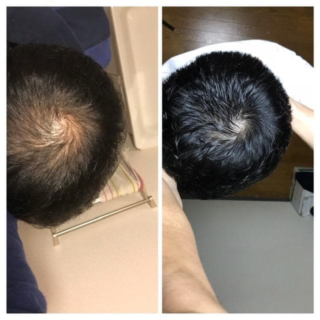レビュー投稿画像