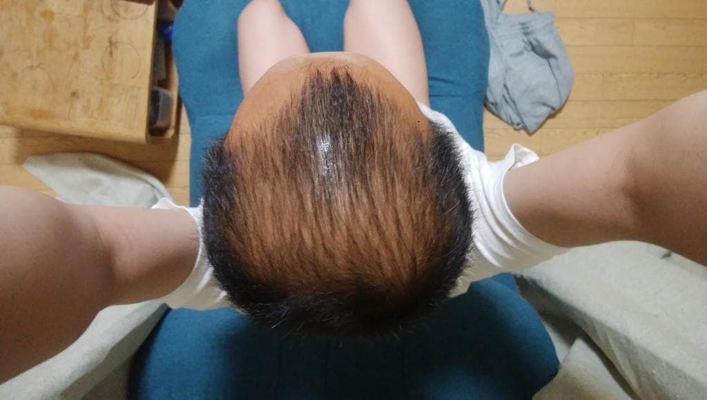 レビュー投稿画像