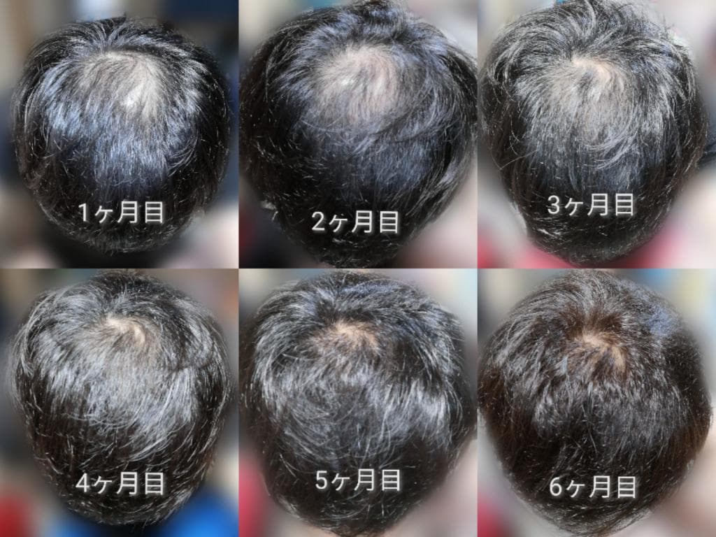 レビュー投稿画像