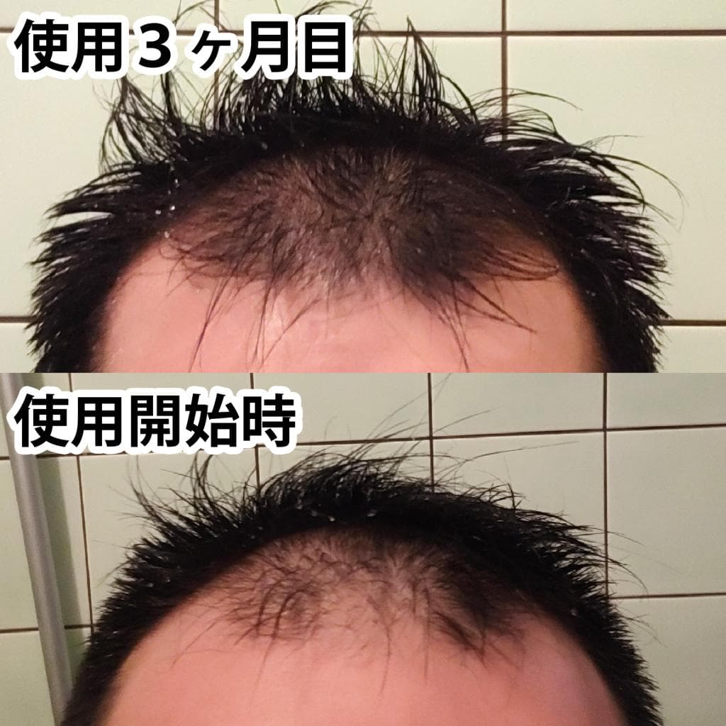 レビュー投稿画像