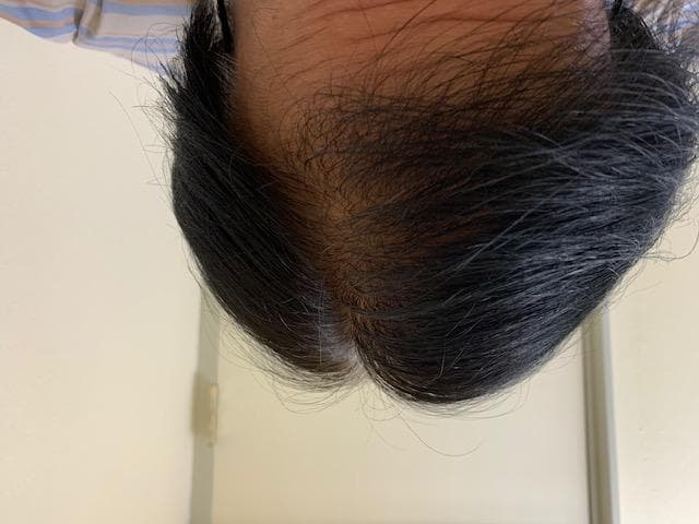レビュー投稿画像