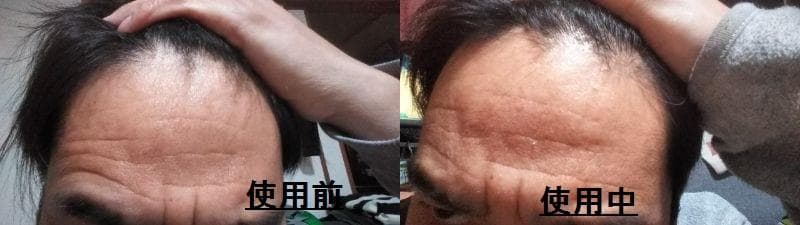 レビュー投稿画像