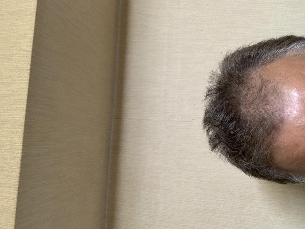 レビュー投稿画像