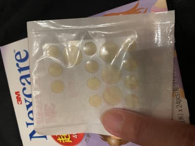 [Nexcare]アクネドレッシング(ニキビパッチ薄型) 【1箱36枚】 レビュー投稿画像 サムネイル