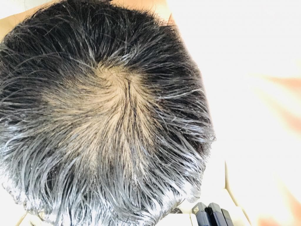 レビュー投稿画像