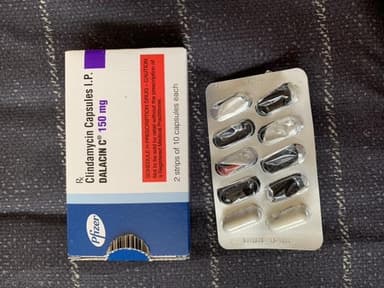 ダラシンC150mg 【1箱20カプセル】 レビュー投稿画像 サムネイル