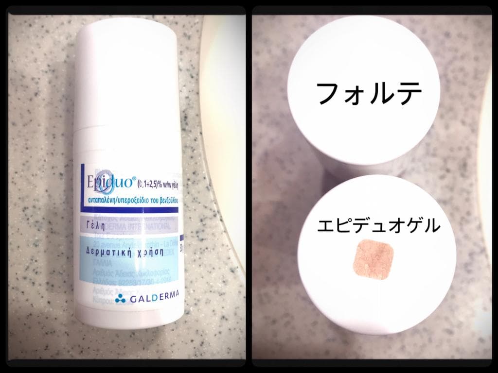 レビュー投稿画像