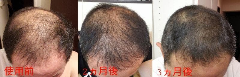 レビュー投稿画像
