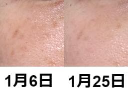 レビュー投稿画像