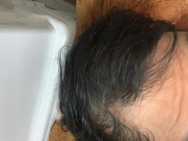 [andro pharma]ヘアー 【1箱30カプセル】 レビュー投稿画像 サムネイル