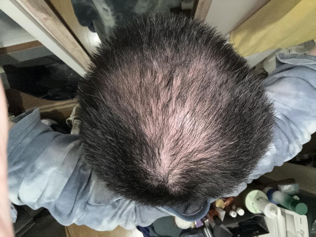 レビュー投稿画像