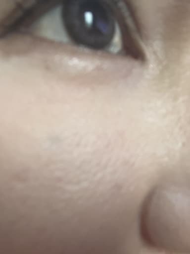 [ラロッシュポゼ]トレリアンセンシティブクリーム 【1本40ml】 レビュー投稿画像 サムネイル