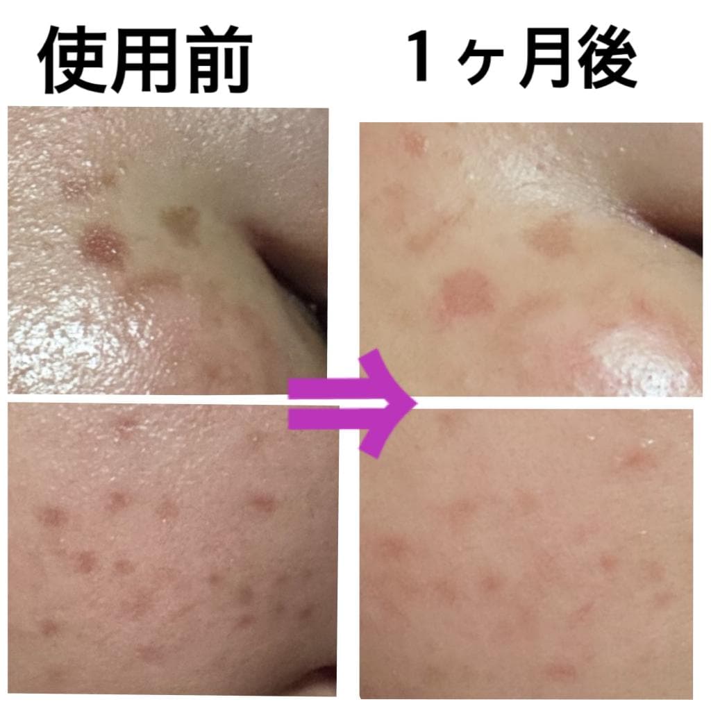 レビュー投稿画像