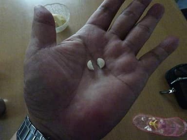 テレソート40LN 【1箱50錠】 レビュー投稿画像 サムネイル