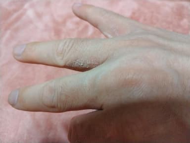 パースピレックス フットローション 【1本100ml】 レビュー投稿画像 サムネイル
