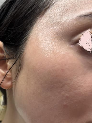 [DERMACEUTIC]アクティブレチノール1.0 【1本30ml】 レビュー投稿画像 サムネイル