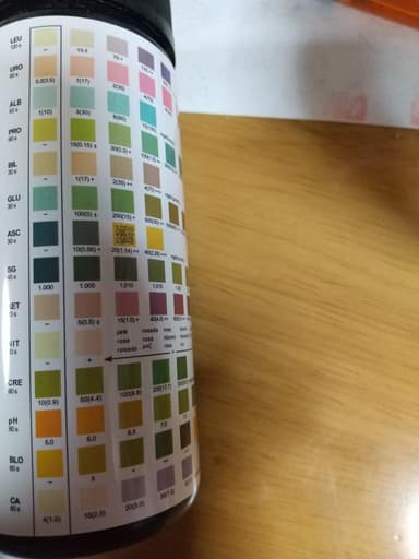 尿検査用試験紙 【1箱100枚】 レビュー投稿画像 サムネイル