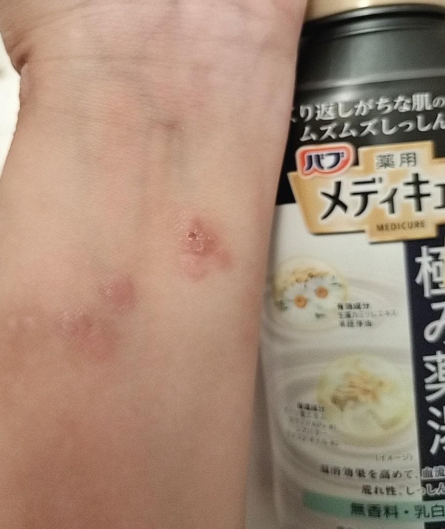 レビュー投稿画像