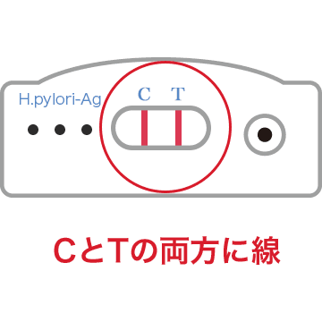 CとTの両方に線