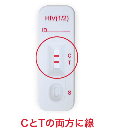 CとTの両方に線